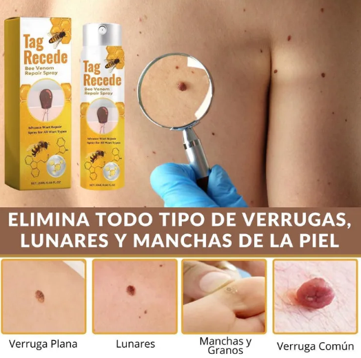 Eliminador de Verrugas y Lunares TagRecede™